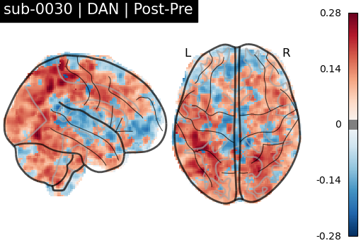 sub-0030_DAN_diff-comparison.png