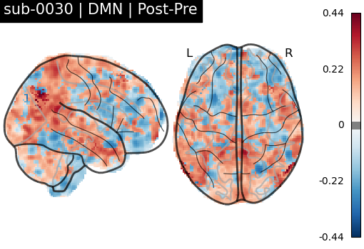sub-0030_DMN_diff-comparison.png