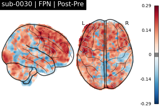 sub-0030_FPN_diff-comparison.png