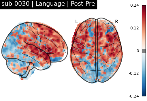 sub-0030_Language_diff-comparison.png