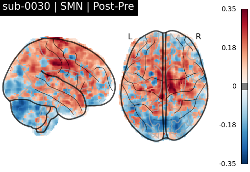 sub-0030_SMN_diff-comparison.png