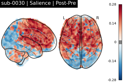 sub-0030_Salience_diff-comparison.png