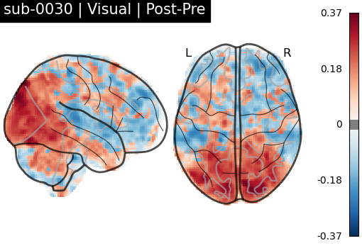 sub-0030_Visual_diff-comparison.png