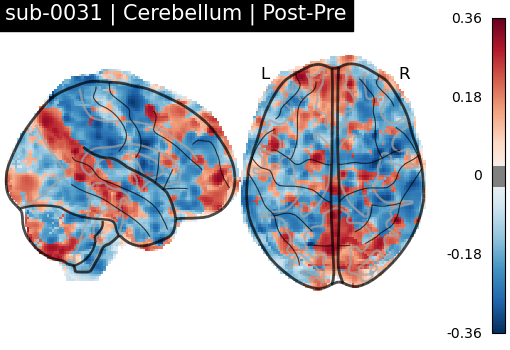 sub-0031_Cerebellum_diff-comparison.png