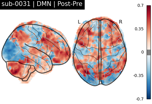 sub-0031_DMN_diff-comparison.png