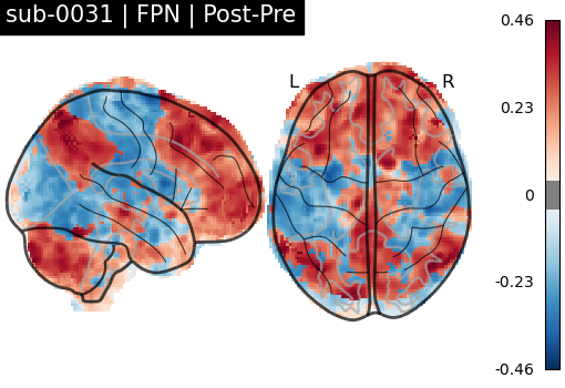 sub-0031_FPN_diff-comparison.png