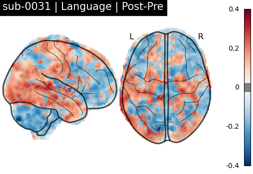 sub-0031_Language_diff-comparison.png