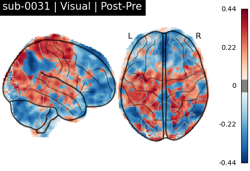 sub-0031_Visual_diff-comparison.png