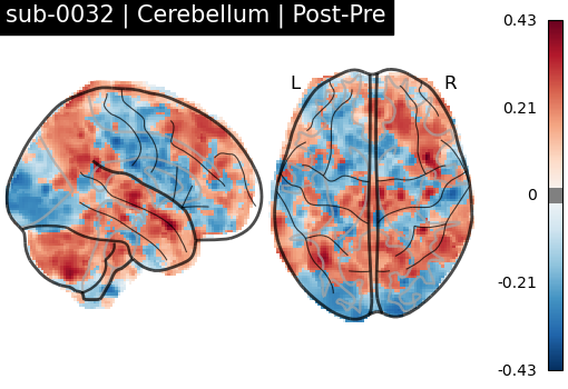 sub-0032_Cerebellum_diff-comparison.png