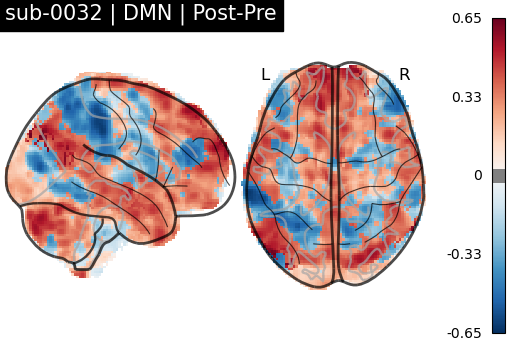 sub-0032_DMN_diff-comparison.png