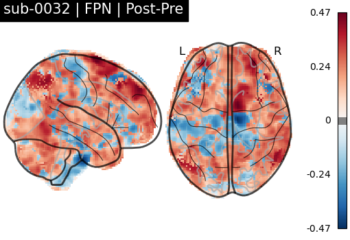 sub-0032_FPN_diff-comparison.png