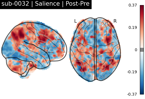 sub-0032_Salience_diff-comparison.png