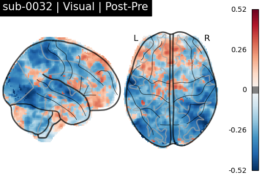 sub-0032_Visual_diff-comparison.png