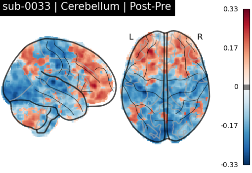 sub-0033_Cerebellum_diff-comparison.png