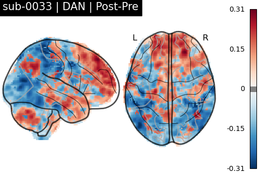 sub-0033_DAN_diff-comparison.png