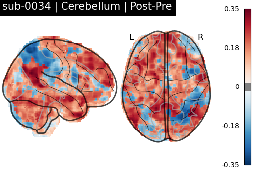 sub-0034_Cerebellum_diff-comparison.png