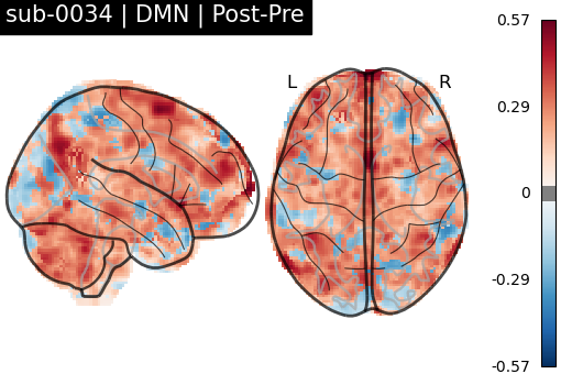 sub-0034_DMN_diff-comparison.png