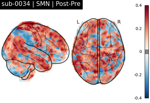 sub-0034_SMN_diff-comparison.png