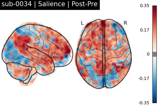 sub-0034_Salience_diff-comparison.png