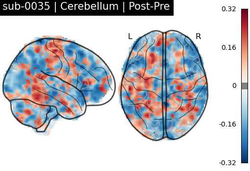 sub-0035_Cerebellum_diff-comparison.png