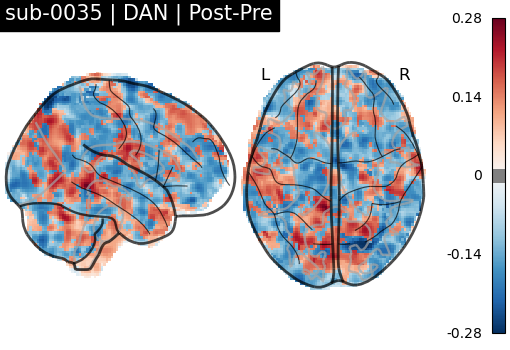 sub-0035_DAN_diff-comparison.png