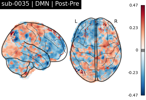sub-0035_DMN_diff-comparison.png