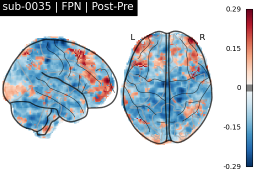 sub-0035_FPN_diff-comparison.png