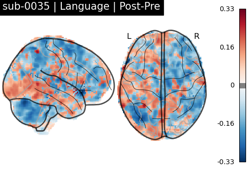 sub-0035_Language_diff-comparison.png