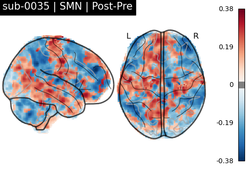 sub-0035_SMN_diff-comparison.png