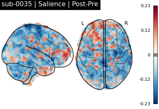 sub-0035_Salience_diff-comparison.png