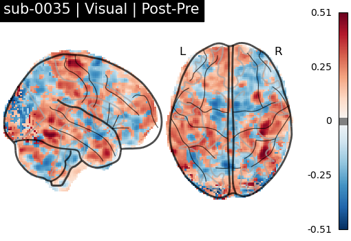 sub-0035_Visual_diff-comparison.png