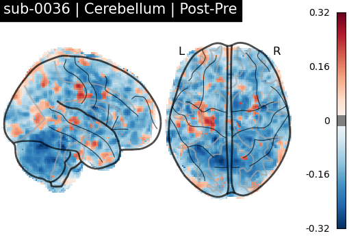 sub-0036_Cerebellum_diff-comparison.png