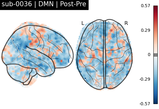 sub-0036_DMN_diff-comparison.png