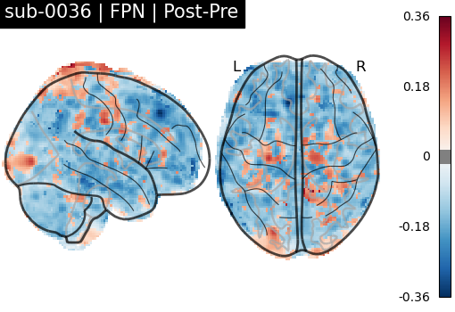sub-0036_FPN_diff-comparison.png
