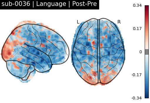 sub-0036_Language_diff-comparison.png