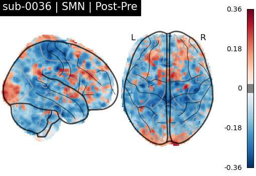 sub-0036_SMN_diff-comparison.png