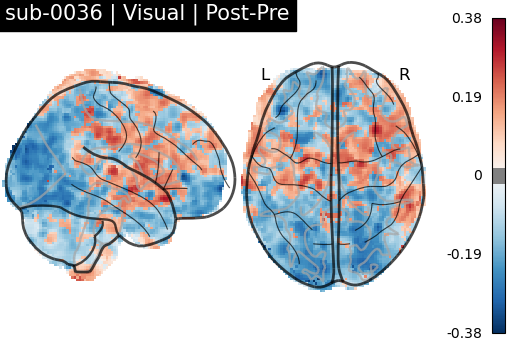 sub-0036_Visual_diff-comparison.png