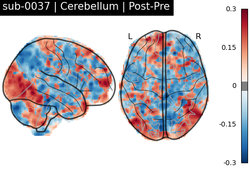 sub-0037_Cerebellum_diff-comparison.png