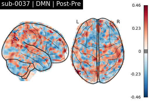 sub-0037_DMN_diff-comparison.png