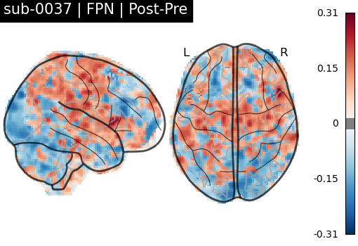 sub-0037_FPN_diff-comparison.png