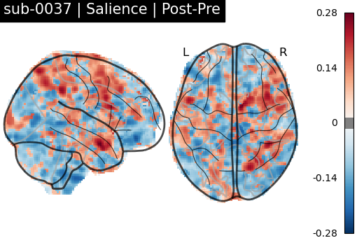 sub-0037_Salience_diff-comparison.png