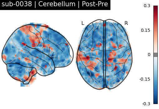 sub-0038_Cerebellum_diff-comparison.png