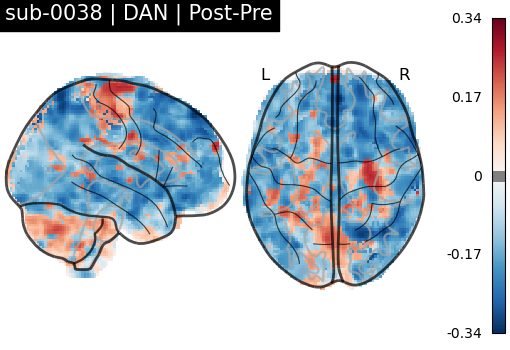 sub-0038_DAN_diff-comparison.png