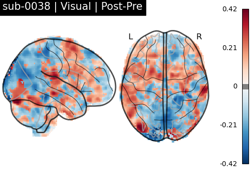 sub-0038_Visual_diff-comparison.png