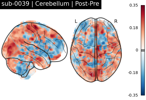 sub-0039_Cerebellum_diff-comparison.png