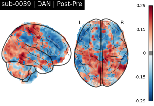 sub-0039_DAN_diff-comparison.png