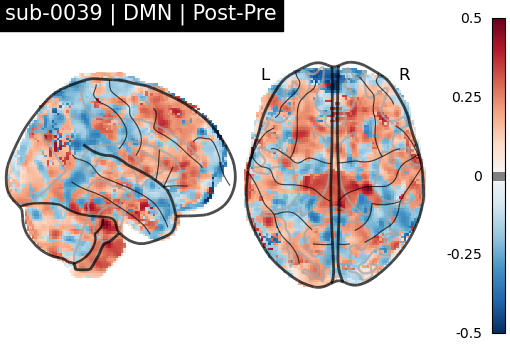 sub-0039_DMN_diff-comparison.png