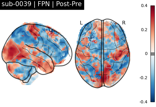 sub-0039_FPN_diff-comparison.png