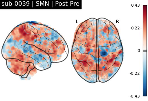 sub-0039_SMN_diff-comparison.png