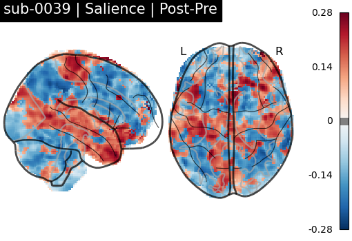 sub-0039_Salience_diff-comparison.png